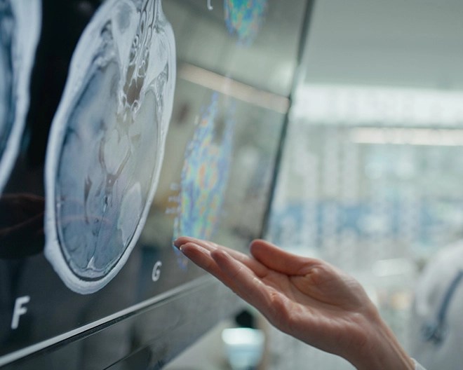 Close-up of a hand pointing to a brain scan.